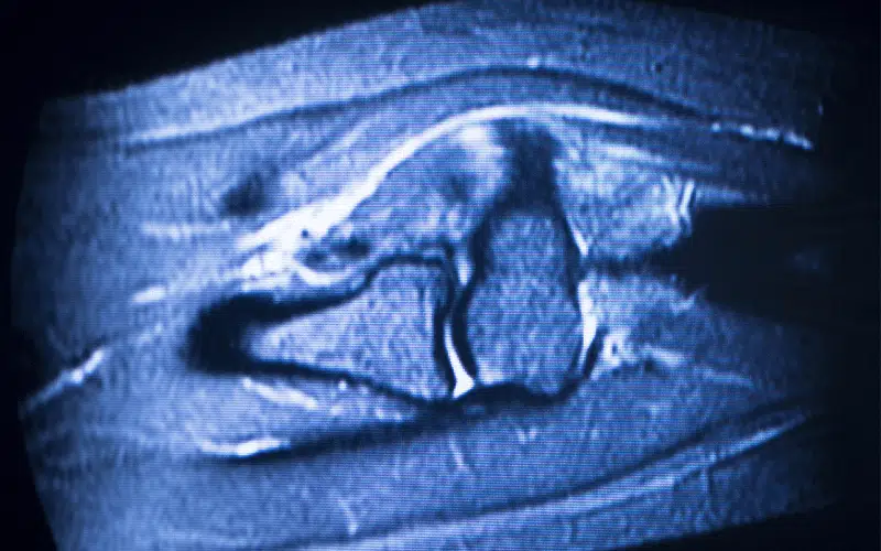 What is MRI and How do you prepare for it